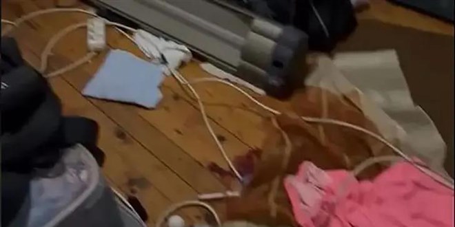 Adana'da keserli kavga: Ağır yaralanan genç 3 gün sonra hayatını kaybetti