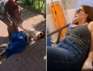 Ayağını kıran Sevda Demirel’in hastanedeki zor anları! Arkadaşına böyle sitem etti