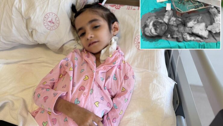 Dünyada bir ilk! 3 kilogramlık tümör 6,5 saatlik operasyonla çıkarıldı