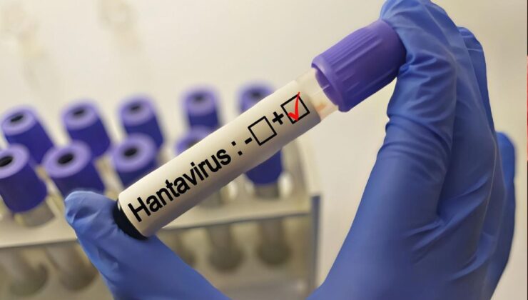 Hantavirüs grip gibi başlıyor! İşte en ayırt edici belirtisi