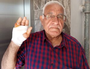 Komşusunun ısırdığı parmağı ampute edildi