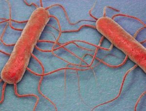 Listeria bakterisi çıkan marka hangisi? Listeria bakterisi nedir, nasıl oluşur? Listeria bakterisi ne yapar, nelerde bulunur?