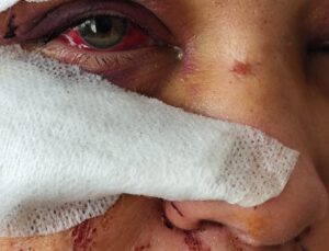Polis memuru eşini yaraladı: Haksız tahrik ve iyi hal indirimiyle tahliye