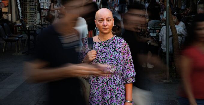 Alopesiyle Barışan Arzu Özsoy, Önyargılara Karşı Mücadele Ediyor