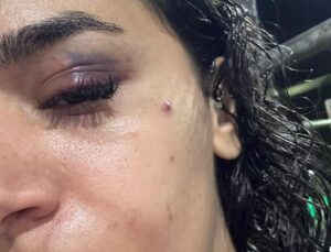 Ebru hemşirenin sesini duyun! “Ölmeden önce…”
