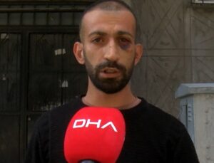 Gaziosmanpaşa’da taciz iddiasıyla darbedilen kiracı: Fatura ödemeleri yüzünden tartıştık